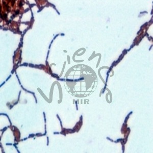 간균(Gram-Nega) 슬라이드표본 간균,슬라이드표본